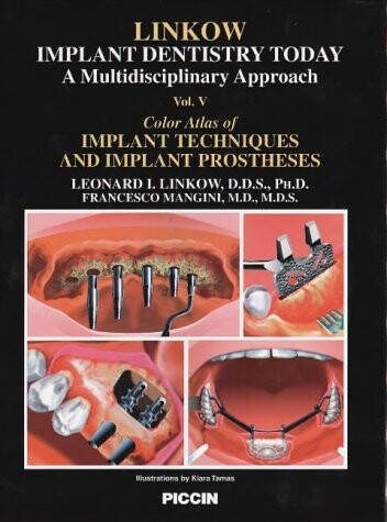 Color Atlas of Implant Techniques and Implant Prostheses (Implant Dentistry Today)