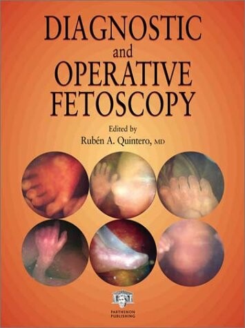 Diagnostic and operative fetoscopy