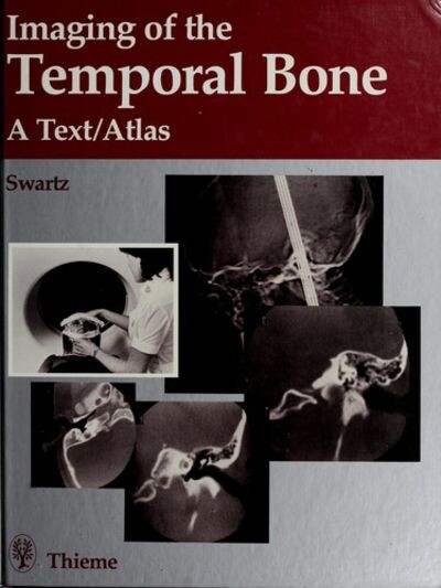 Imaging of the Temporal Bone