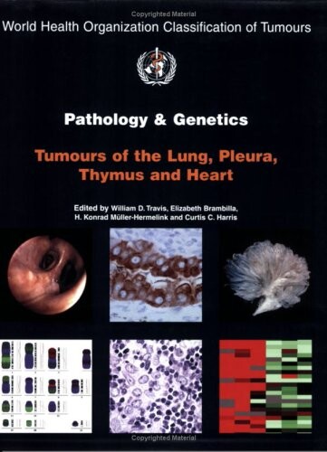 Pathology and genetics of tumours of the lung, pleura, thymus and heart