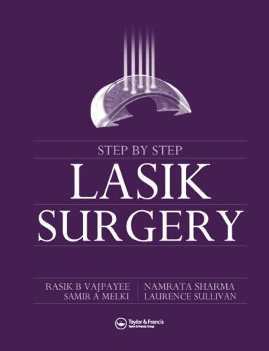 Step by step LASIK surgery