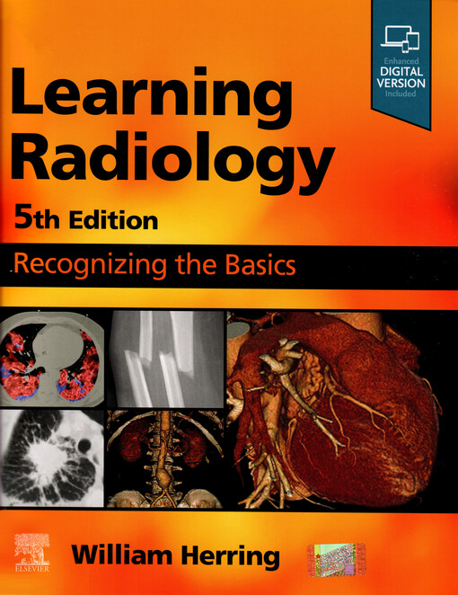 Learning radiology: recognizing the basics
