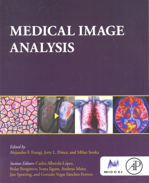 Medical image analysis