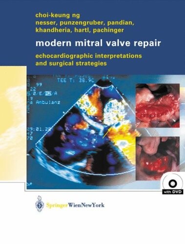 Modern Mitral Valve Repair: Echocardiographic Interpretations and Surgical Strategies