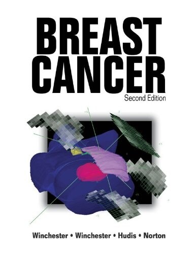 Breast Cancer (Atlas of Clinical Oncology)
