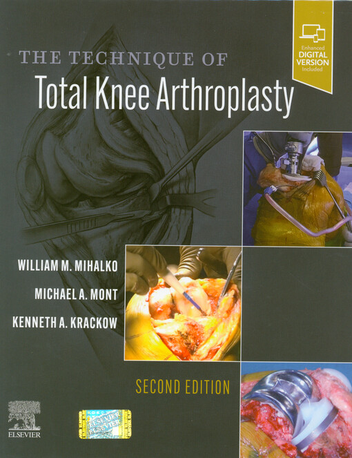 The technique of total knee arthroplasty