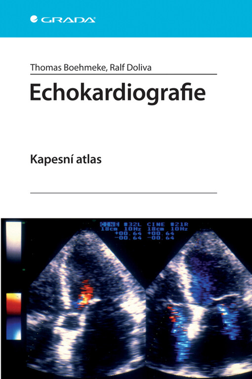Echokardiografie : kapesní atlas