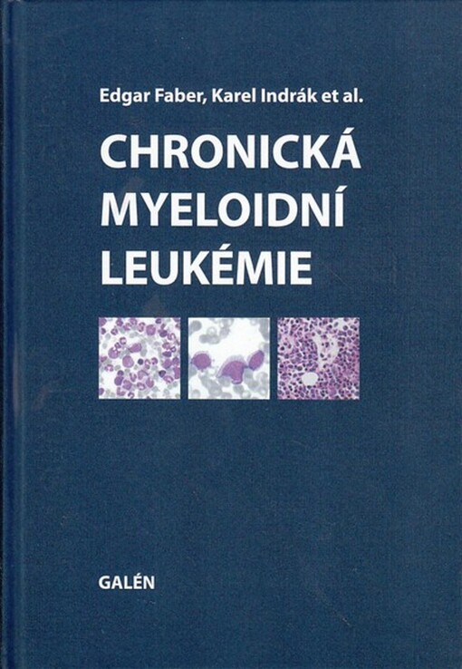 Chronická myeloidní leukémie