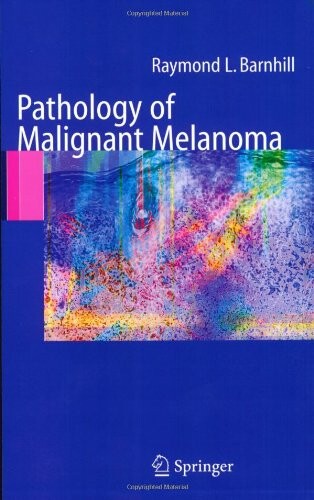 Pathology of Malignant Melanoma