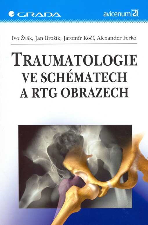 Traumatologie ve schématech a RTG obrazech | Žvák Ivo, Brožík Jan, Kočí Jaromír, Ferko Alexander - e-kniha
