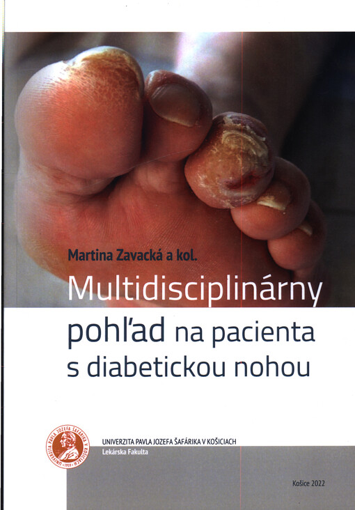 Multidisciplinárny pohľad na pacienta s diabetickou nohou