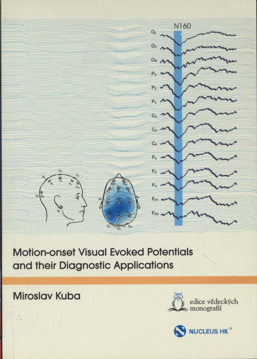 Motion-onset visual evoked potentials and their diagnostic applications