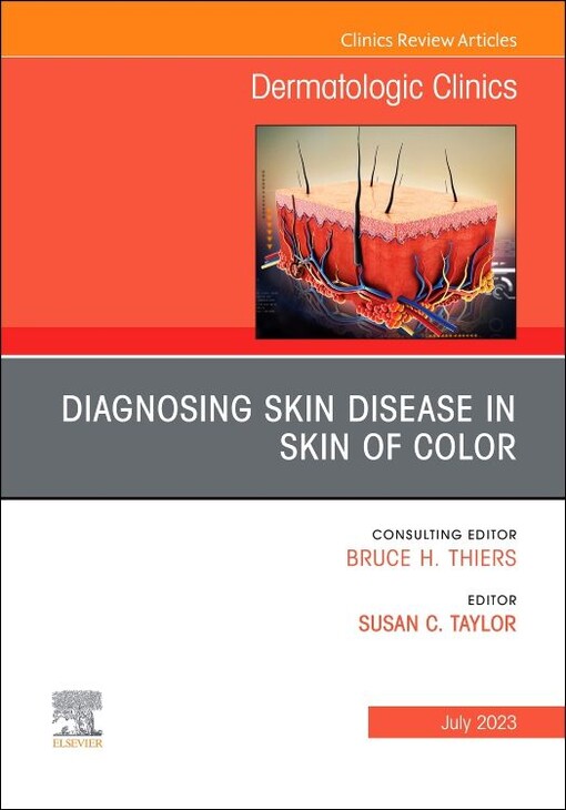 Diagnosing skin disease in skin of color