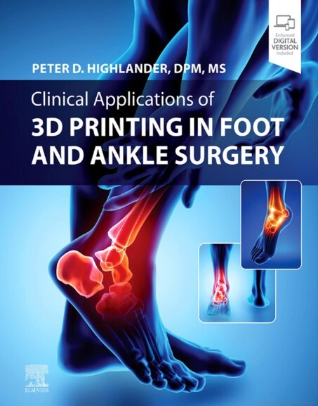 Clinical applications of 3D printing in foot and ankle surgery