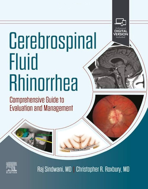 Cerebrospinal fluid rhinorrhea : comprehensive guide to evaluation and management