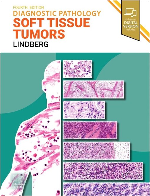 Diagnostic pathology : soft tissue tumors