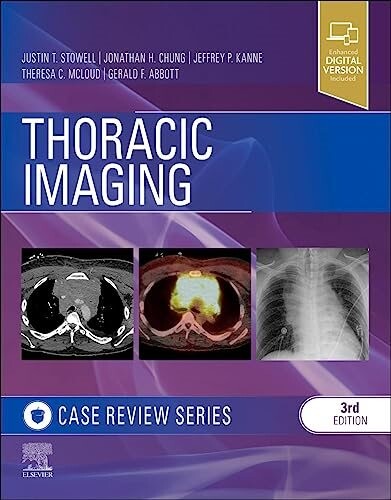 Thoracic imaging : case review series