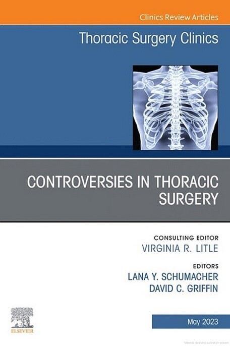 Controversies in thoracic surgery