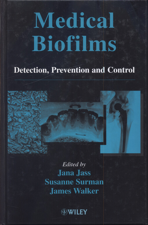 Medical Biofilms : Detection, Prevention and Control