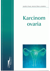 Karcinom ovaria  (odkaz v elektronickém katalogu)