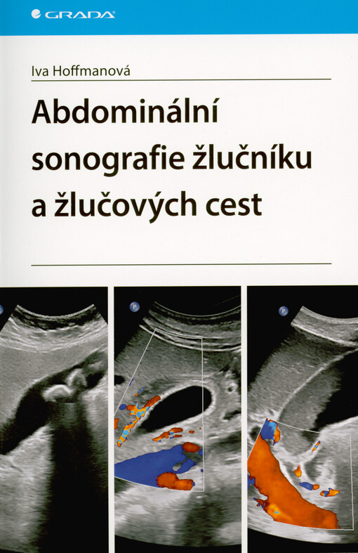 Abdominální sonografie žlučníku a žlučových cest