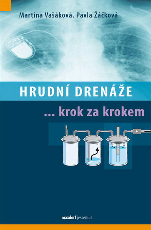 Hrudní drenáže krok za krokem