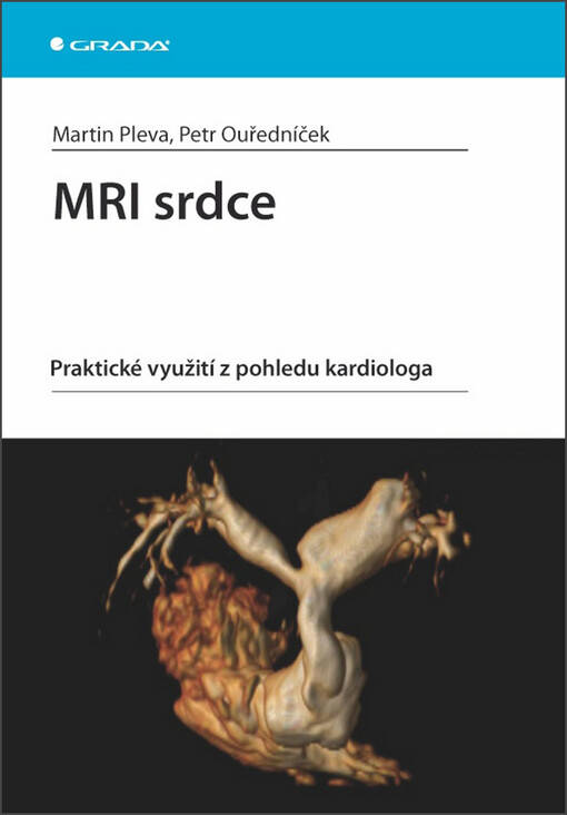 MRI srdce : praktické využití z pohledu kardiologa