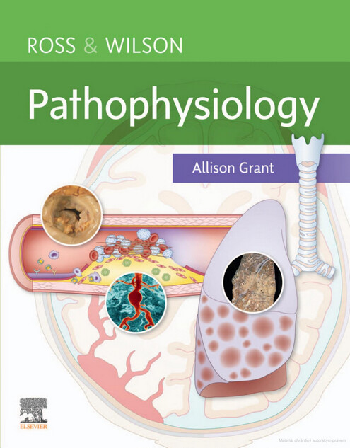 Ross & Wilson pathophysiology