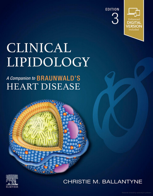 Clinical lipidology : a companion to Braunwald’s heart disease