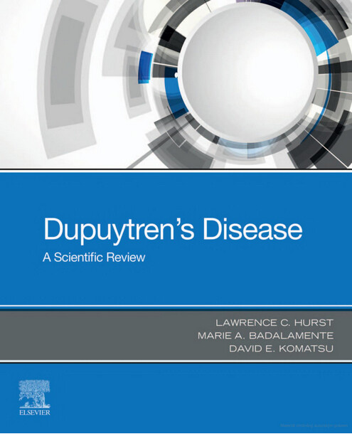 Dupuytren's disease : a scientific review