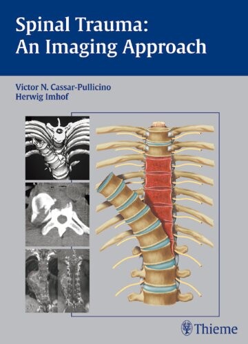 Spinal Trauma: An Imaging Approach