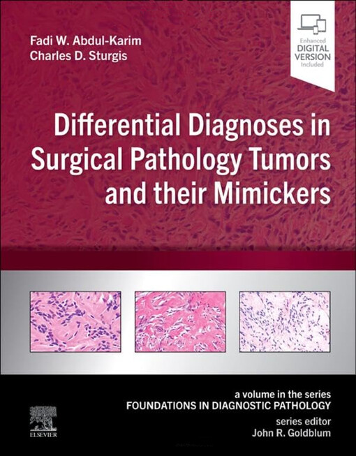 Differential diagnoses in surgical pathology tumors and their mimickers : a volume in the series Foundations in diagnostic pathology