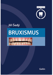 Bruxismus  (odkaz v elektronickém katalogu)
