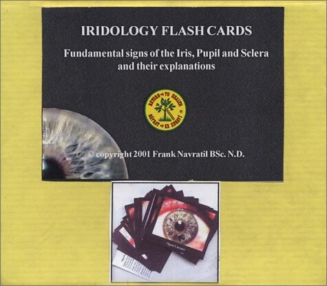 Fundamental iridology signs [fundamental signs of the iris, pupil and sclera and their explanations]