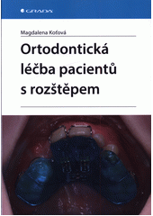 Ortodontická léčba pacientů s rozštěpem  (odkaz v elektronickém katalogu)