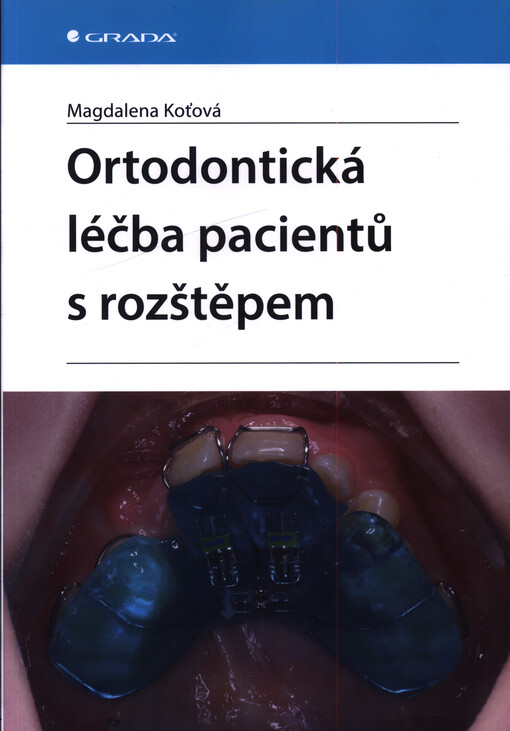 Ortodontická léčba pacientů s rozštěpem