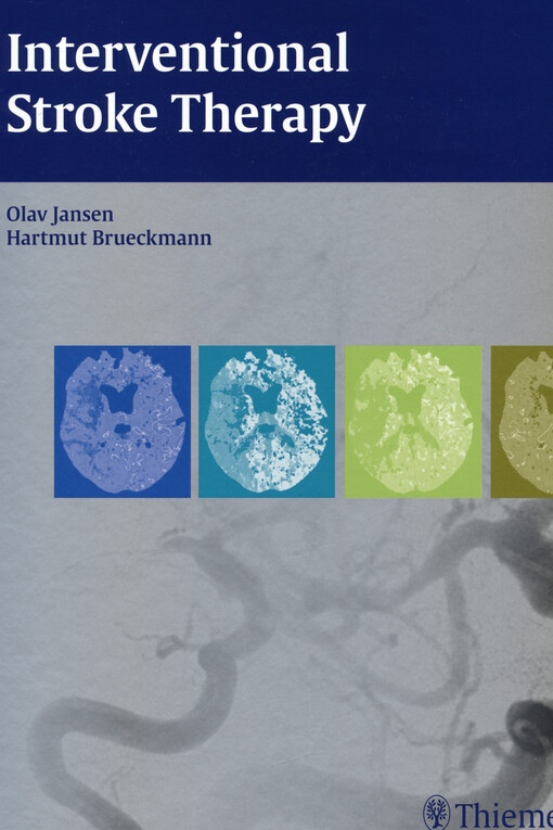 Interventional stroke therapy