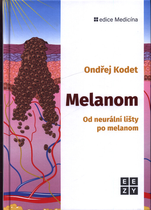Melanom : od neutrální lišty po melanom
