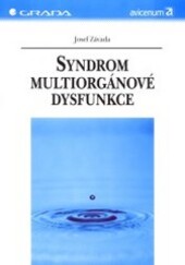 Syndrom multiorgánové dysfunkce