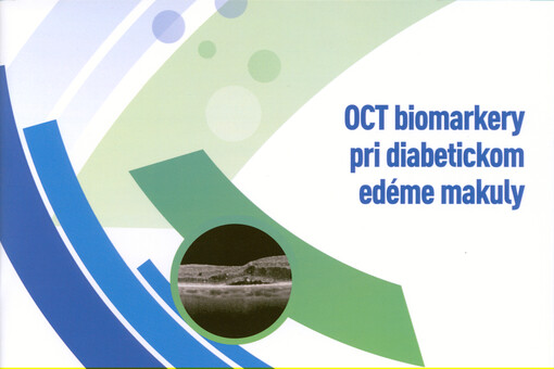 OCT biomarkery pri diabetickom edéme makuly