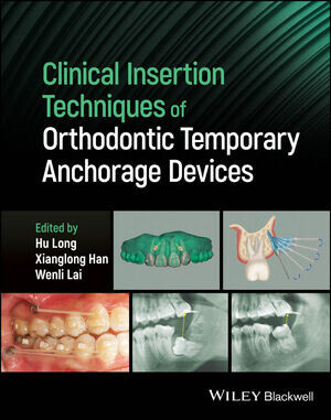 Clinical insertion techniques of orthodontic temporary anchorage devices