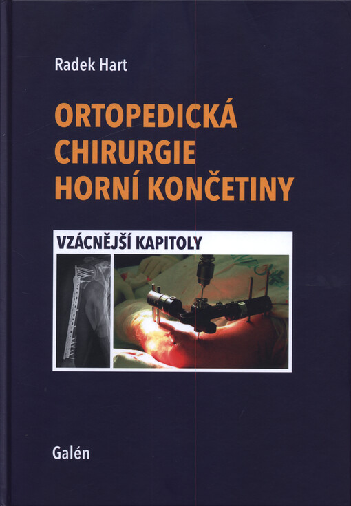 Ortopedická chirurgie horní končetiny