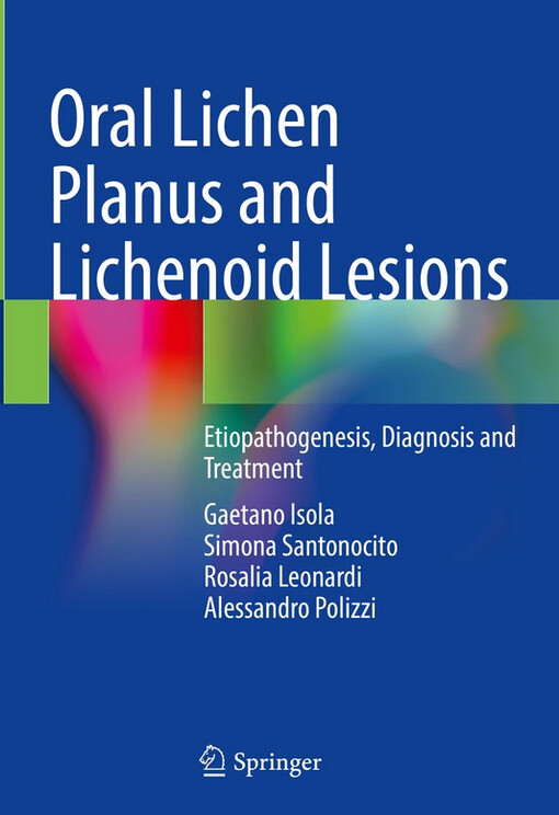 Oral lichen planus and lichenoid lesions : etiopathogenesis, diagnosis and treatment