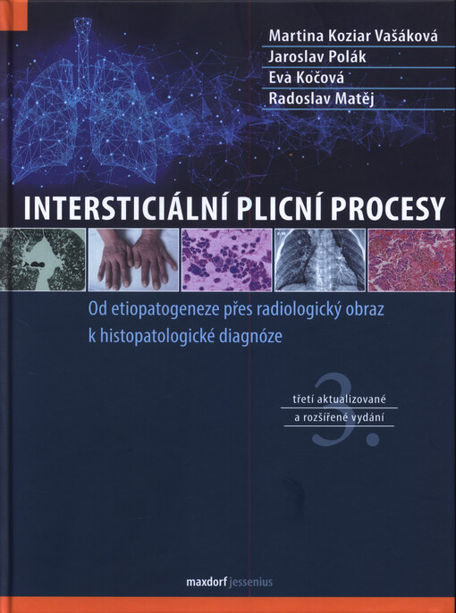 Intersticiální plicní procesy