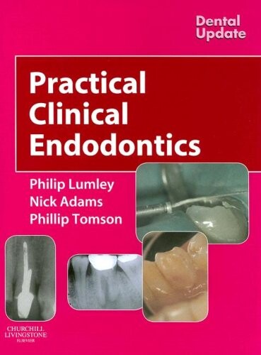Practical clinical endodontics