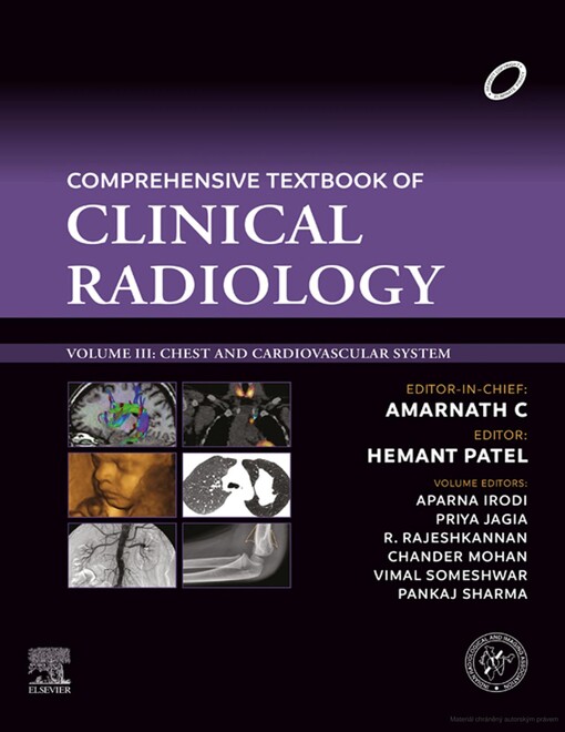 Comprehensive textbook of clinical radiology. Volume II, central nervous system