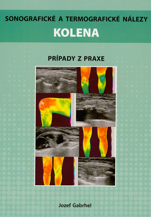 Sonografické a termografické nálezy kolena : prípady z praxe