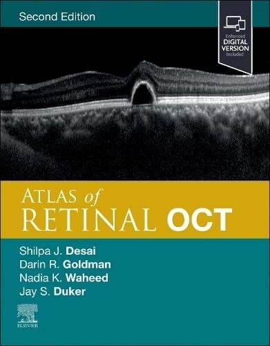 Atlas of retinal OCT: optical coherence tomography