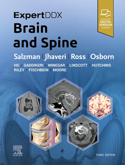 Expert DDX : brain and spine
