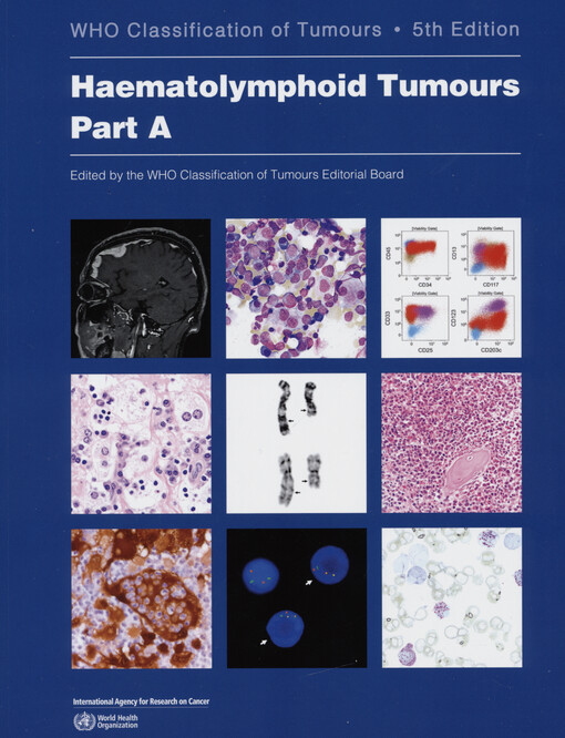 Haematolymphoid tumours. Part B